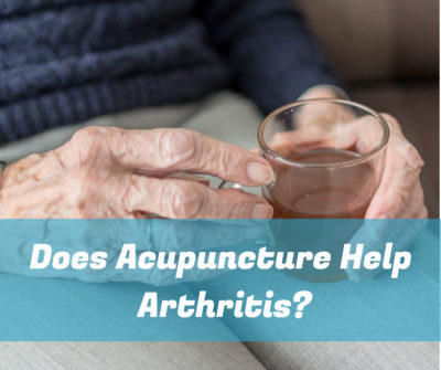 Does Acupuncture Help Arthritis 1